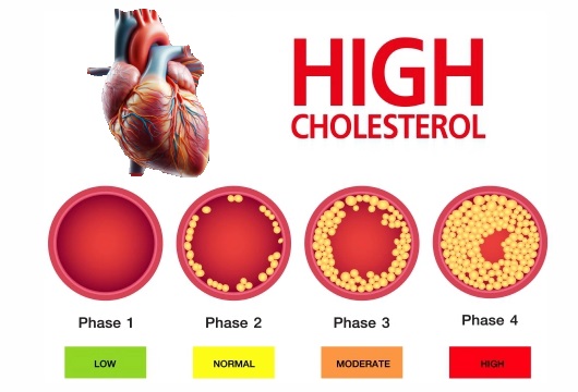 10 Foods that Fight High Cholesterol: What to Eat and Why